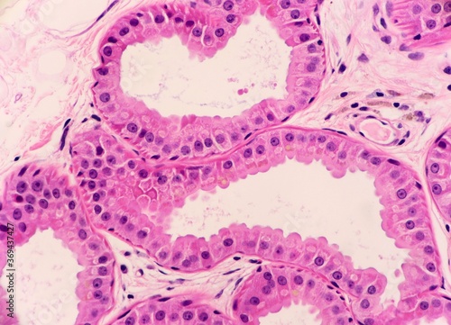 Apocrine sweat glands from the underarm or axilla area with granular pink epithelial cells. Microscopic view.