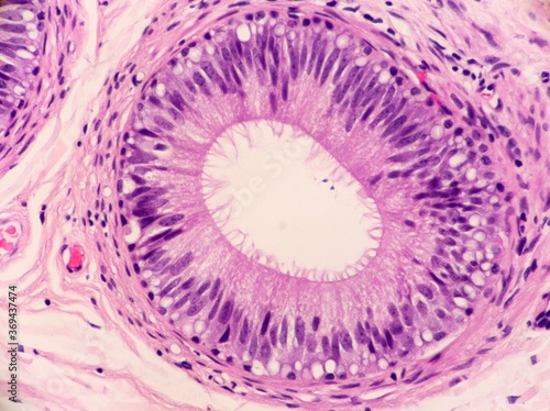 Bild auf Leinwand Tubules of the epididymis lined by ciliated epithelial cells and containing a few sperm which look like tiny dark dots