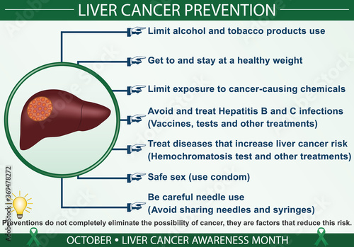 Liver cancer prevention infographic vector. October liver cancer awareness month concept. Well-organized Eps 10 file.