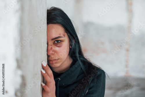 Portrait of beaten young woman with bruise under eye that standing and leaning on the wall indoors in abandoned building photo