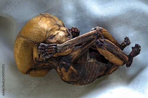 Human mummified fetus of unknown date. Right side view. photo