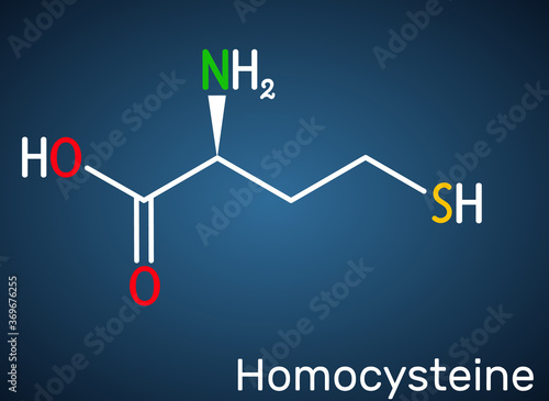 Homocysteine biomarker molecule. It is a sulfur-containing non-proteinogenic amino acid. Structural chemical formula on the dark blue background