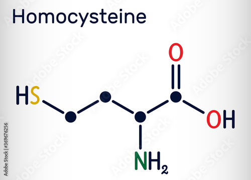 Homocysteine biomarker molecule. It is a sulfur-containing non-proteinogenic amino acid. Skeletal chemical formula