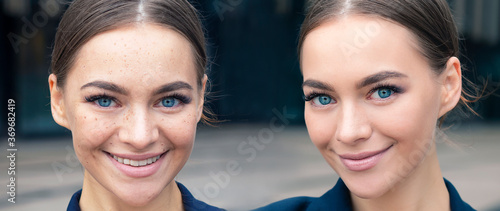 Tablou pe pânză Comparison portrait of beautiful happy woman with problematic skin