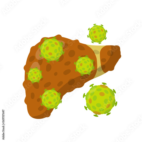 Bad liver. Attack germs and cirrhosis of the liver. Health problem. Medical Disease of human internal organ