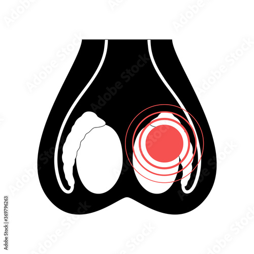 Reproductive system concept