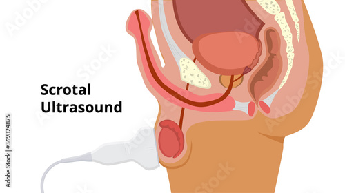 Scrotal ultrasound scan process. Male roproductive system anatomy and examination