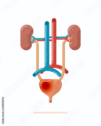 Illustration of human urinary system with disease, such like a cystitis, contains kidneys, ureter, urinary bladder, urethra and vessels, flat design vector illustration