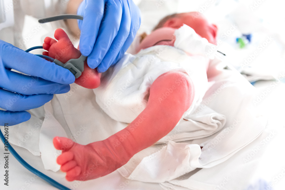 Nurse in blue gloves is putting on the foot of neonatal infant pulse