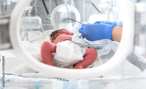 Photo of a premature baby in incubator. Focus is on his feet. Nurse in blue gloves is using the feeding tube for feeding premature baby. Neonatal intensive care unit