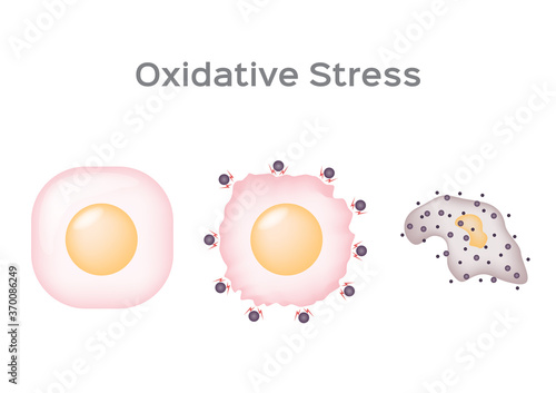 Oxidative Stress cell vector / free radical