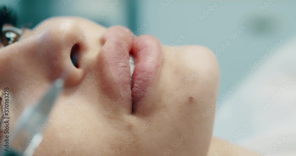 Treatment of mimic wrinkles under the eyes, full face reduces unwanted signs of aging including wrinkles around eyes, neck and mouth young skin results. Treatment of mimic wrinkles under the eyes, full face reduces unwanted signs of aging including wrinkles around eyes, neck and mouth young skin results.