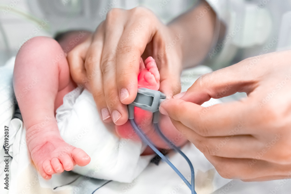 Nurse is putting on the foot of neonatal premature infant pulse