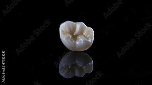 Foto excellent composition of ceramic inlay morphology with creative reflection on bl