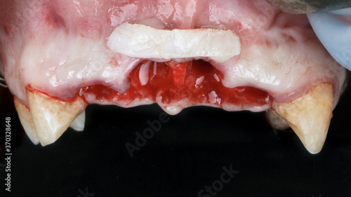 the addition of a soft tissue flap during implantation of central teeth