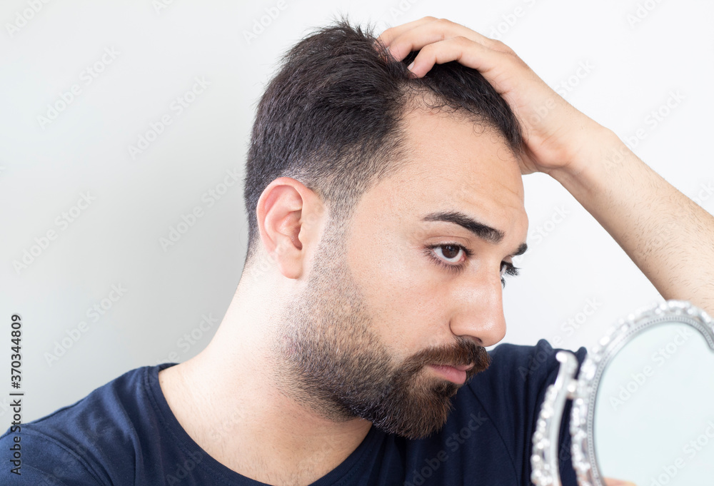 Fototapeta premium Portrait of a man worried about hair loss
