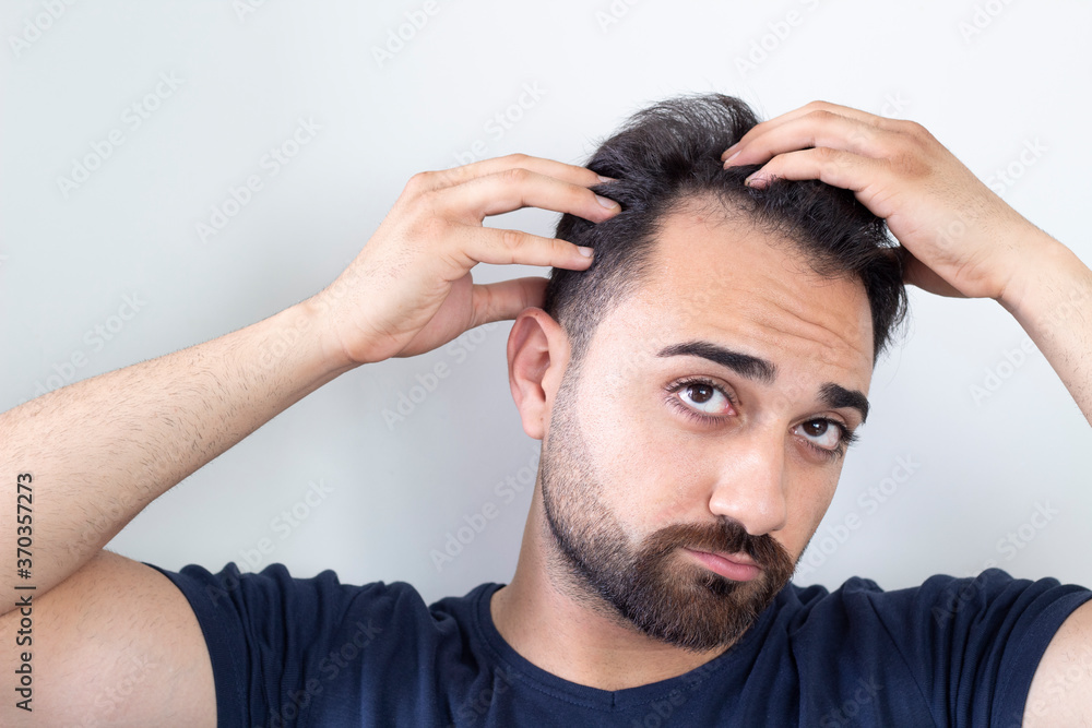 Portrait of a man worried about hair loss Portrait of a man worried about hair loss