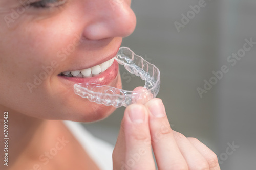Woman wearing orthodontic silicone trainer. Invisible braces aligner. mobile orthodontic appliance for dental correction.