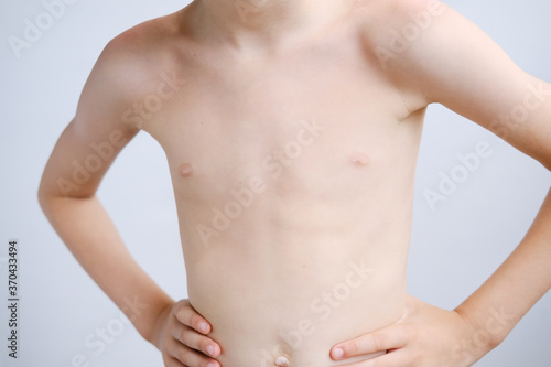 kid, a boy of primary school age with a naked torso, slender structure, ribs, belly, the concept of children's health, happy childhood