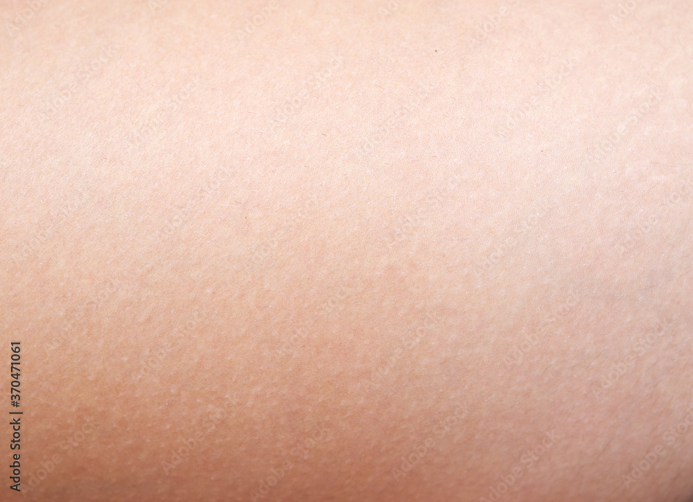 Skin texture Skin texture