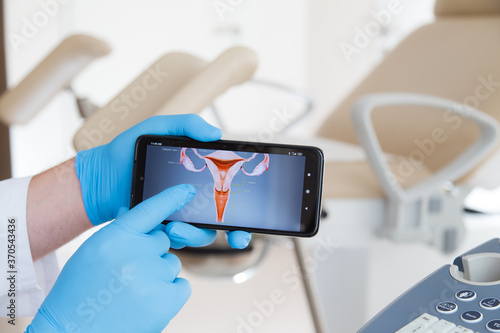 Ręka lekarza w niebieskiej rękawiczce pokazuje na monitorze telefonu ilustrację szyjki macicy. 