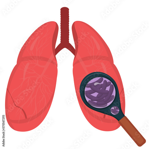 Magnifying glass and tuberculosis. The structure of the lungs