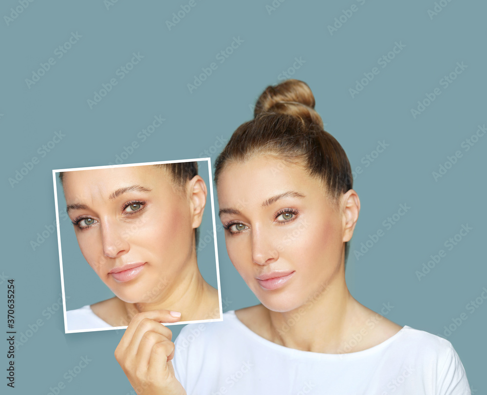 Effects of ageing,Frown/scowl lines ,Nasolabial folds,Neck ,Under eye circles,neck lines