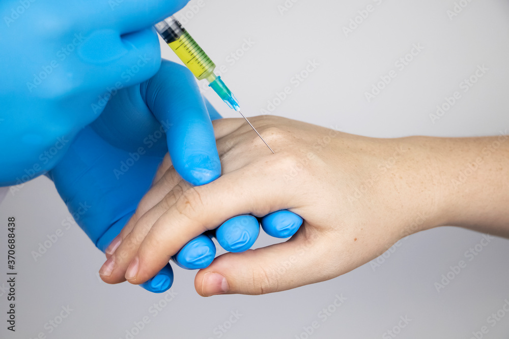 Orthopedic surgeon gives an injection in the finger joint. Treatment of osteoarthritis with hormonal drugs or drugs based on hyaluronic acid. Help with diseases that damage the cartilage of the joint Orthopedic surgeon gives an injection in the finger joint. Treatment of osteoarthritis with hormonal drugs or drugs based on hyaluronic acid. Help with diseases that damage the cartilage of the joint