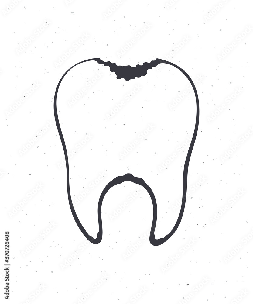 Obraz premium Unhealthy human tooth with caries. Outline. Vector illustration. Symbol of somatology and oral hygiene. Hand drawn sketch. Isolated white background
