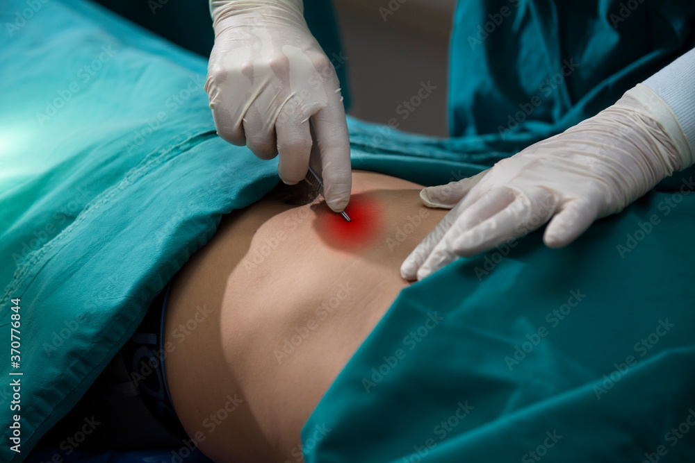 Medical of surgeons in hospital doing minimal invasive surgical interventions. Surgery emergency at operating room. Medical of surgeons in hospital doing minimal invasive surgical interventions. Surgery emergency at operating room.