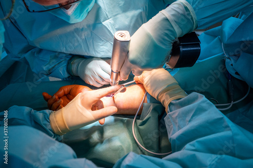 Fényképezés 2 doctors operate on a wrist fracture in an operating theatre