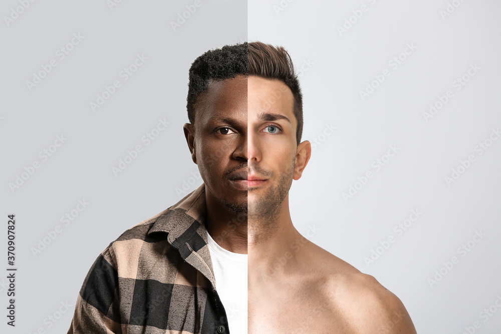 Obraz premium Handsome young man on light background. Plastic surgery concept