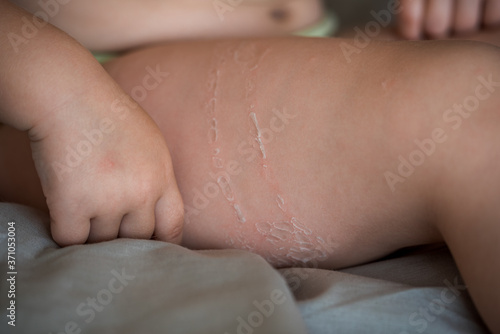 Cute little baby girl at the pediatrician's appointment, nice young woman doctor in a white medic lab coat with gentleness glues a band on girl's knee, child in the hospital