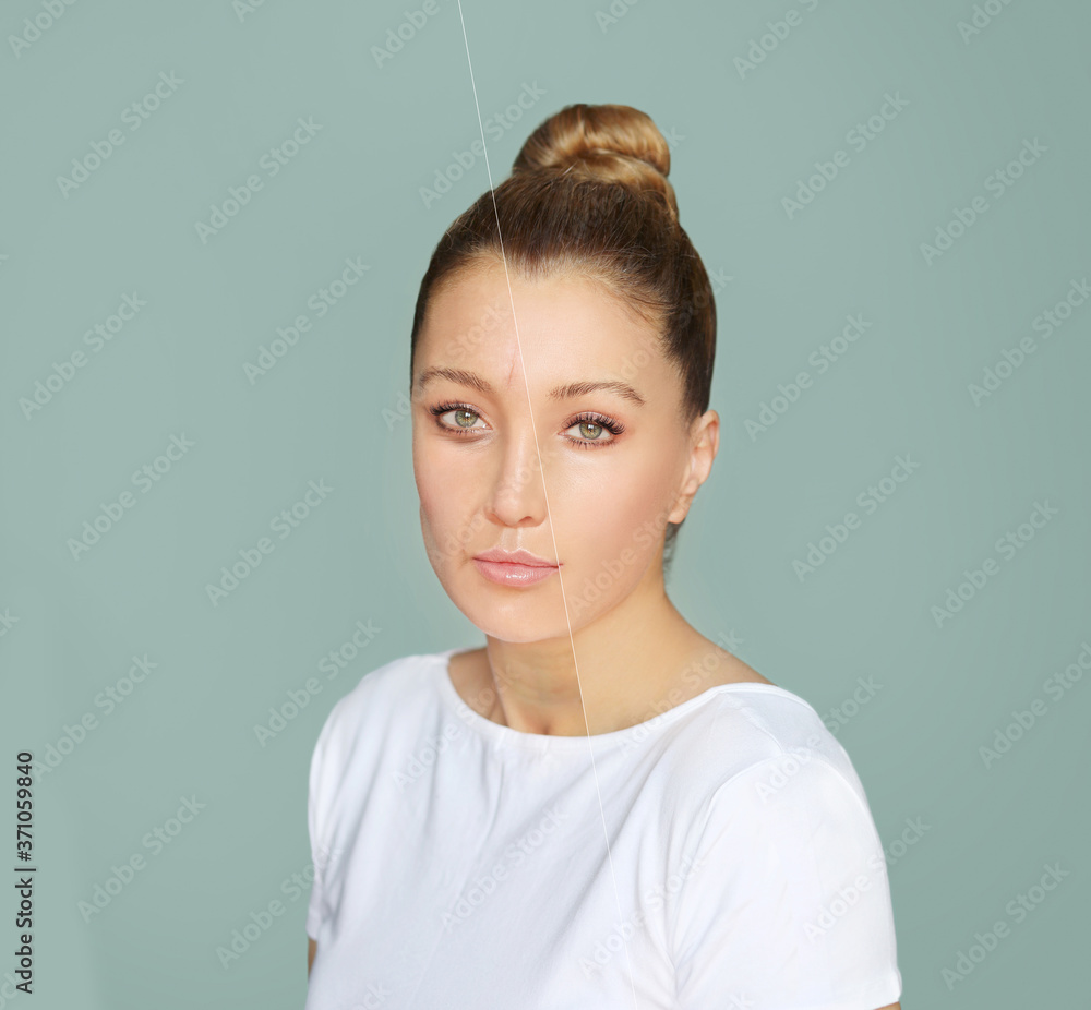 Effects of ageing,Frown/scowl lines ,Nasolabial folds,Neck ,Under eye circles,neck lines