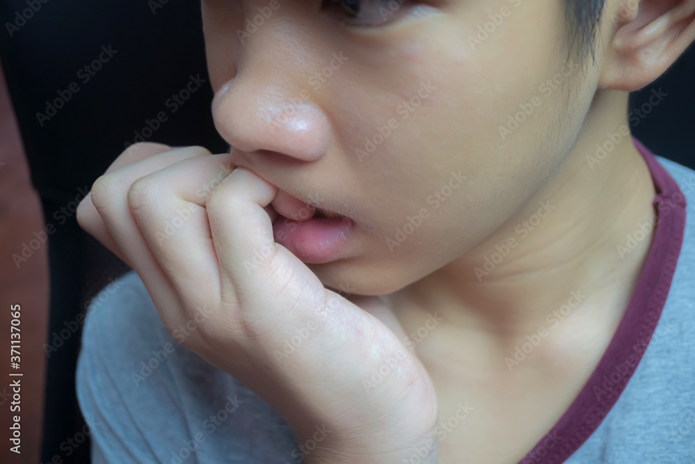 The boy is biting the nail. The cause may be due to stress the child biting the nail should immediately see a doctor for urgent treatment, stress until causing the man's nail-biting for the background