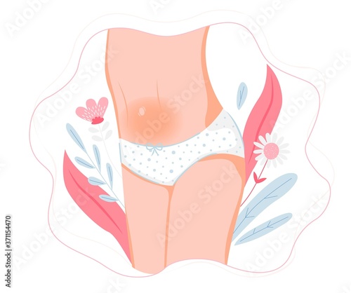 Woman has abdominal pain because of her periods. Woman's health illustration with woman body, female groin and panty. Vector illustration on flower background.