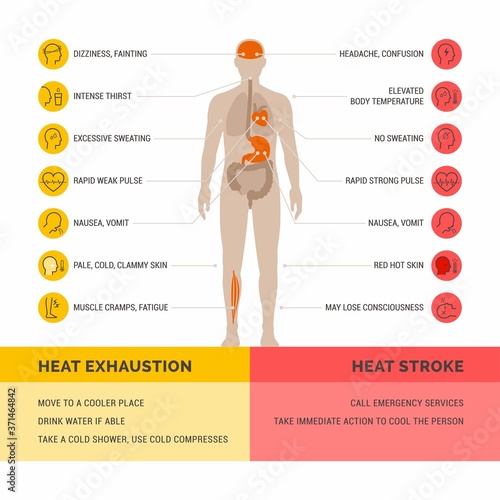 Heat exhaustion and heast stroke infographic photo