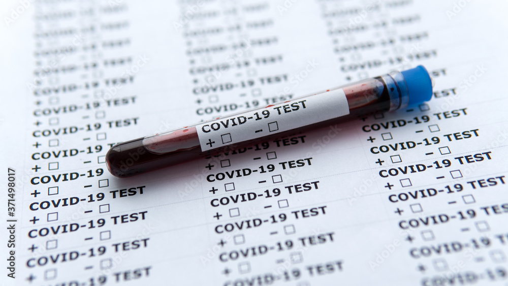 Obraz premium Test tube with blood sample for COVID-19, isolated on white paper with text. Coronavirus test. There is no mark that is positive or negative test result from Coronavirus Covid-19. A blood test.