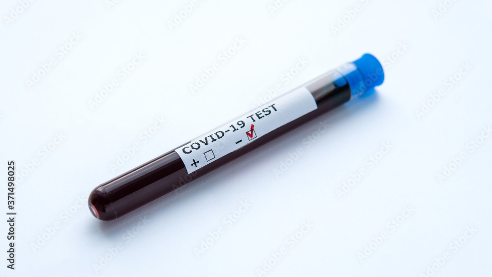 Negative test result from Coronavirus Covid-19. Isolated test tube with blood sample for COVID-19. Coronavirus test. A blood test for the presence of the virus. Medical concept. Negative test result from Coronavirus Covid-19. Isolated test tube with blood sample for COVID-19. Coronavirus test. A blood test for the presence of the virus. Medical concept.