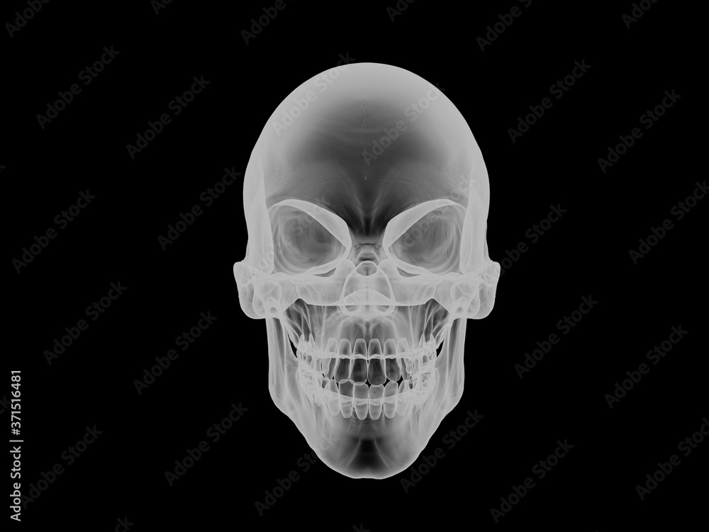 Skull - front view - x ray visual effect Skull - front view - x ray visual effect