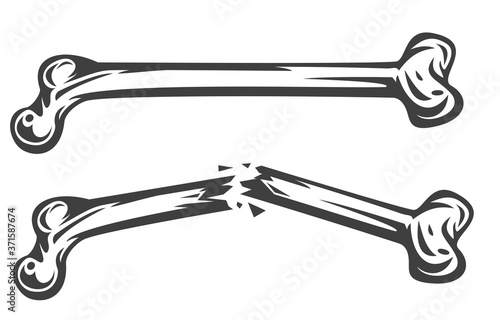 Vintage monochrome whole and broken bone isolated on white background. Hand drawn design element template for emblem, print, cover, poster. Vector illustration.