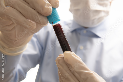 Doctor in gloves and facial mask holding vacuum tube with blood