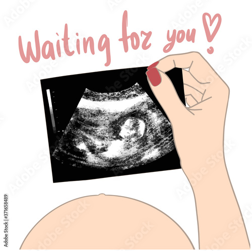 Waiting For you. Baby ultrasound picture in hands pregnant girl vector illustration. Fetus silhouette in mother womb, pregnancy diagnostic sonography or ultrasonography 