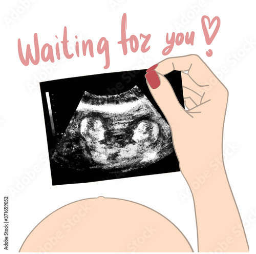 Baby twins ultrasound picture in hands pregnant girl vector illustration. Fetus silhouette in mother womb, pregnancy diagnostic sonography or ultrasonography concept isolated on white background