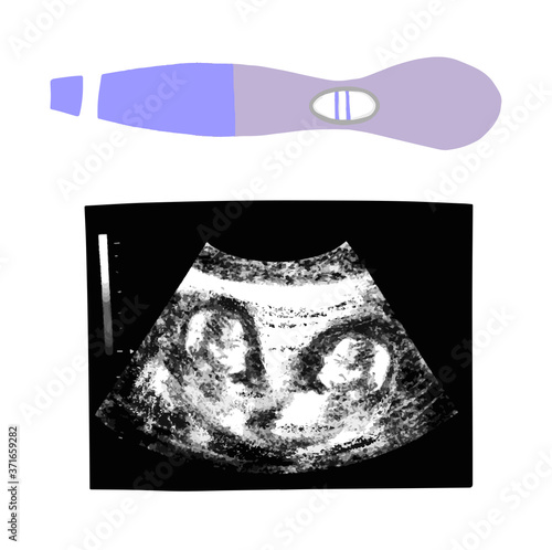 Baby boy twins ultrasound picture. Fetus silhouette in mother womb, pregnancy diagnostic sonography or ultrasonography concept isolated on white background