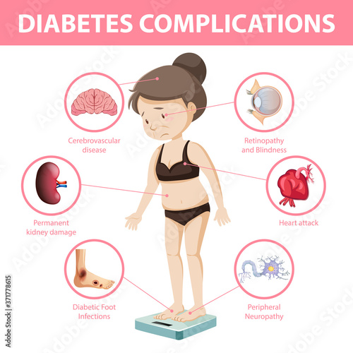 Diabetes complications information infographic