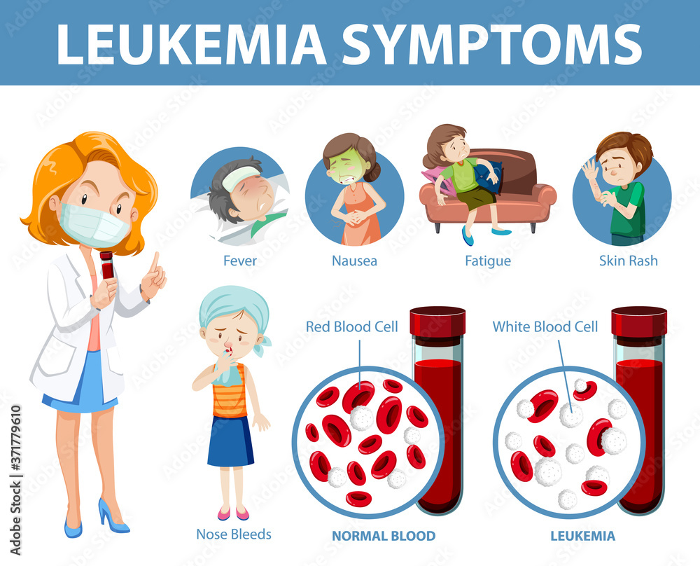 Leukemia Symptoms Cartoon Style Infographic Stock Vector Adobe Stock leukemia-symptoms-cartoon-style-infographic-stock-vector-adobe-stock