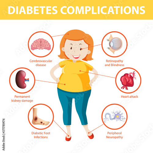Diabetes complications information infographic