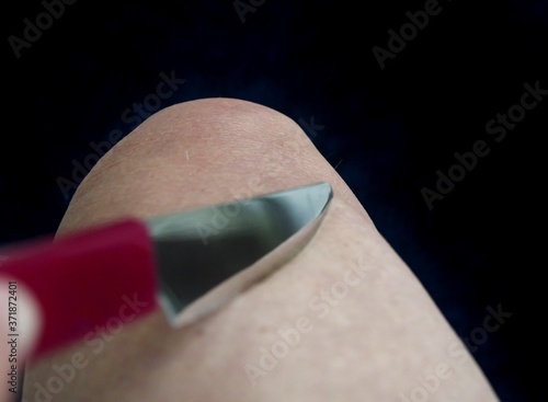 Messer sticht in Bein photo