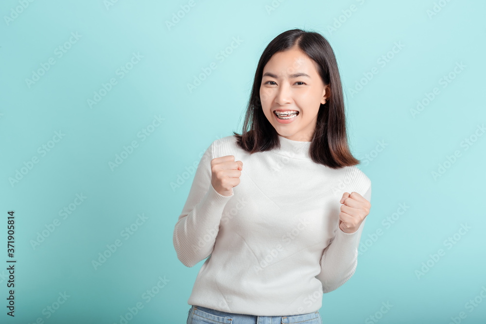 Dental braces of young asian woman wearing braces with white teeth concept. Dental braces of young asian woman wearing braces with white teeth concept.
